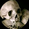 yorick_2283