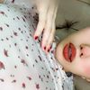 lyn__877