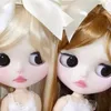 えくぼ