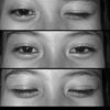 citra_inalanu