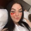 gonorrleah