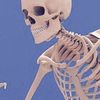 skellistoned