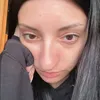 mmet_