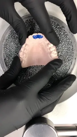 This is how we make retainers✌🏼#foryou #howto #fyp #braces #viral