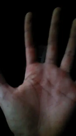 after cleaning up the blood off my hands on the school bus 😭😥😢