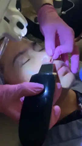 Extractions! Make sure to hold that skin taut! 💅🏼 #acne #extraction #skincare #facialtreatment #esthetician #dermalogica #pores #acnetreatment