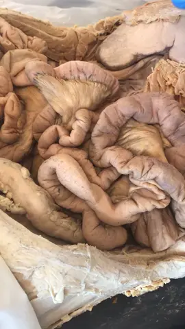 MESENTERY!! Subscribe to us on YouTube! #wellnesstips #healthylife #anatomy #education #scienceclass