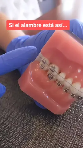 Por si te pasa esto en cuarentena #cuarentena #ortodoncia #brackets #ortodoncista