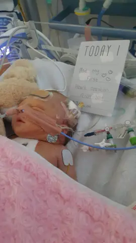 My heart warrior 💗💓💞#fighter#openheart#surviver ##Love#chdawareness #chd #doner#heartwarrior #congenitalheartdefect #heart #brompton #bromptonbaby