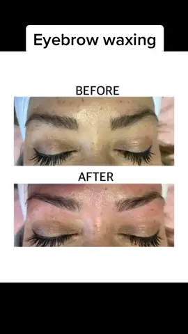 Eyebrow waxing #skincare #bodywaxing #waxing #satisfying #foryoupage #wax #fyp #oddlfysatisfying #facemask #facial