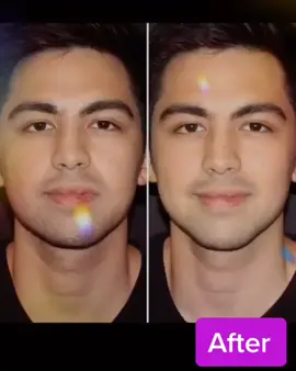 How to get a sharp jawline? #JawlineCheck #sharpjaw #foryou #fyp #foryoupage #trending #viral #BeloBeauty #fillers #beautyprocedures #beauty