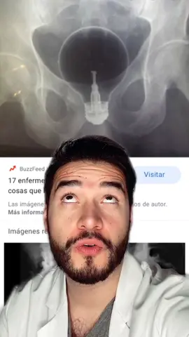 LAS COSAS MÁS RARAS ENCONTRADAS EN R3CTOS 🥴😥😱 #xray #datoscuriosos #doctor