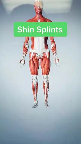 Shin Splints #physicaltherapy #Running #runnerthings