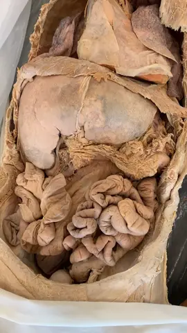 RETROPERITONEAL!! The peritoneum divides the abdominal cavity into anterior and posterior sections. #LearnOnTikTok #tiktokpartner #education #anatomy