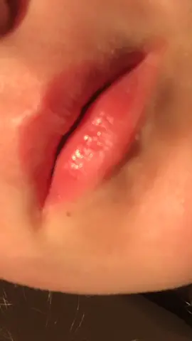 I have a question. How do you get rid of swollen gums?