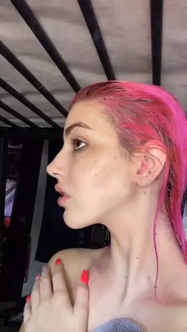 ⚠️BLOOD WARNING ⚠️  Allurant Aesthetics medical spa !!! I wanted a stronger jaw line and chin and that’s what I got #foryou #plasticsurgery #fillers