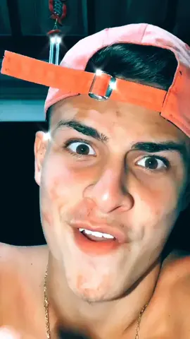 Me conta aí, como não enxerga? #foryou #for #py #paravoce #brasil #viral #foryoupage