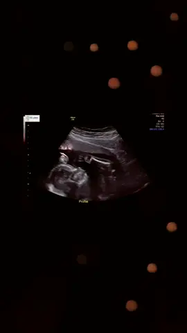 Chris&Yessi's gender reveal🙏💙💙 #fyp #foryou #genderreveal #imatiaagain #issssaboy #nephewlove #bigbrother #family @yessiyessi.r