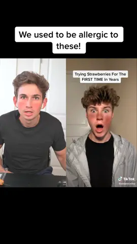 Allergic reactions 🥴 @aidanrowley #premierepro #editingvideo #allergies #BeautyTutorial #foryou