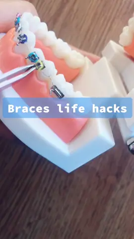 Quick tips for common braces issues! #tiktokpartner #LearnOnTikTok #dentist #braces #lifehacks