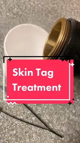 Skin tag treatment #BeautyEssentials #208skindoc #boise #idaho #skintag