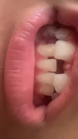 Sorry if I have ugly teeth