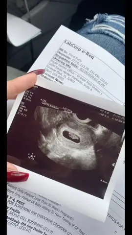 33 weeks & 4 days. my third trimester has been so rough but i love my lil man more and more every day already 🥺💛 #fyp #teenpregnancy #babyboy