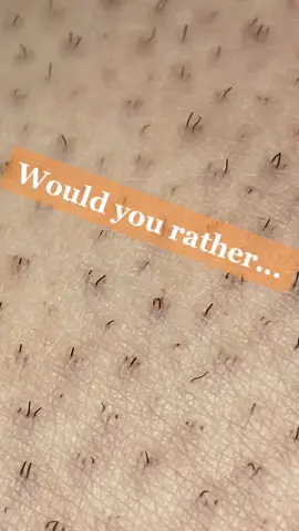 Check out my YT 🐷 #WhatsYourPower #SoAwkward #ingrownhair #satisfying #mystrangeaddiction #fyp #hairpull