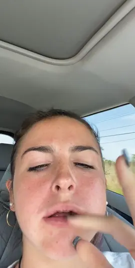 me after getting my wisdom teeth out🤩 my teeth aren’t yellow, its just blood🥰