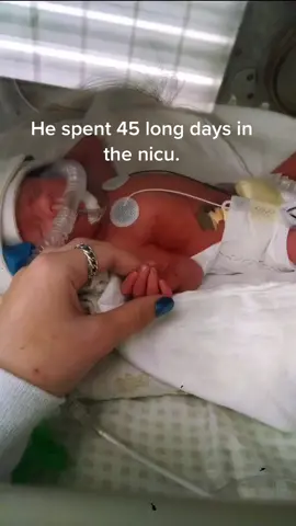 my sweet boy 🤍 #nicu #greenscreen #teenmom #boymom #nicuawarenessmonth #happy #life #thatswhatilike