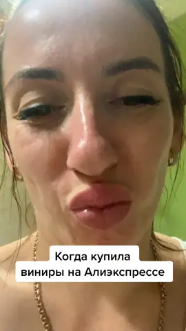 Виниры #хочуврек #яюморист #юмор