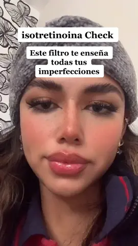 #colorit un gran cambio para mi :) #fyp #acutanecheck #isotretinoina #perfectskin #skinchallenge #pielbonita #pielperfecta #byeacne