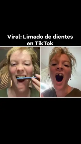 Nuevo challenge viral muy peligroso, no lo hagas! #parati#foryou#foryoupage#fy#fyp#fypシ#noticias#new#news#viral#tiktok#challenge#estopasohoy