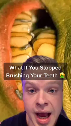 What If You STOPPED Brushing Your TEETH 🤮 #whatif #teeth #EduTok #educational #learning #fyp