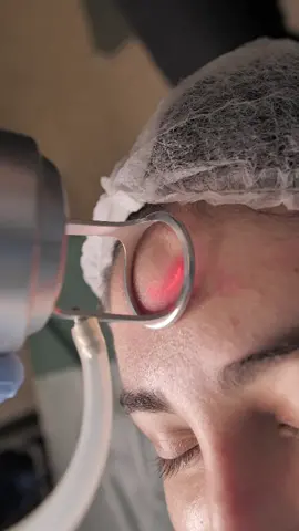 Лазерная шлифовка лица 🔥 #карпинский #пластическийхирургкиев #пластическаяхирургиякиев #лазернаяшлифовкакиев