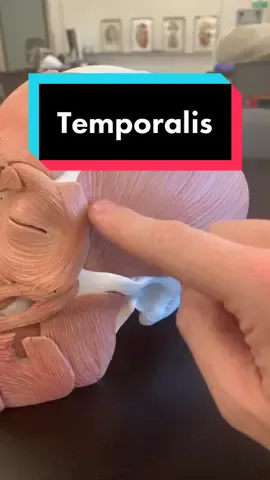 TEMPORALIS!! The term “temple” refers to “temporal”, which means “of time”. #LearnOnTikTok #TikTokPartner #chewing #anatomy