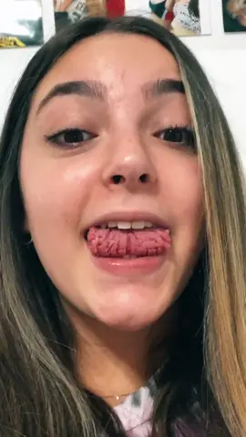 get it? #geographictongue #fissuredtongue