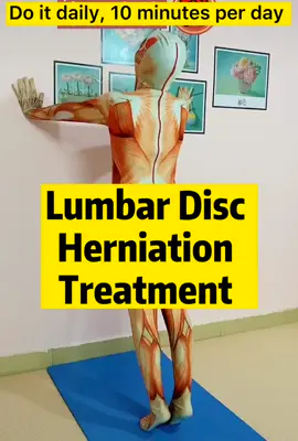 Lumbar Herinated Disc? Do it daily, you will feel much better #herinateddisc #treatyourself #natureheal #healthylife #bekind #acupuncture