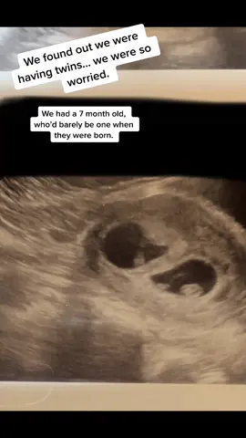 I love to look back on this first year with 3 babes. Wouldn’t change a thing. #REMDreamCheck#twins#twinmom#baby#pregnant#ourstory#mom#fyp#foryou