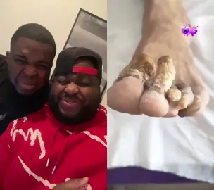 #duet with @minke328  please people Take care of your feet 🦶🏾! #fyp #foryoupage  @imdavidnoire  😂😂😂