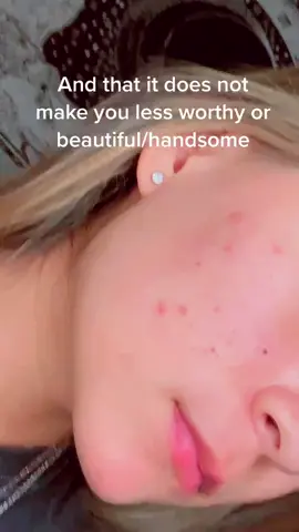 embrace it! #spirituality #positivity #affirmations #spirtualawaking