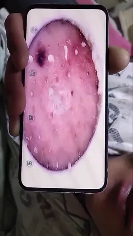 Decompression #decompression #Wee