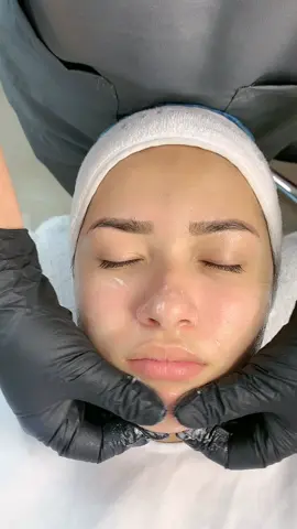 Limpieza facial profunda #foryou #fy #fyp #extraccion #parati