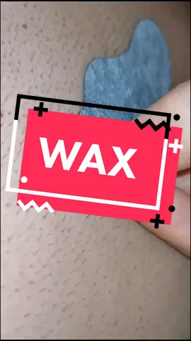 Wax using nose stripe.. Multiple hair follicle#fypシ #fypage #foryourpage #fyp #wax #waxing #nosestrips #viral #february #2021 #hair #hairy #hairyback