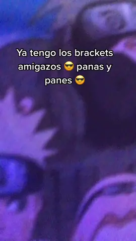 🍕A👄 :) estaré en stream mostrándoles cómo están mis dientes xd 😎STREAM DENTISTA😎 JPlayjeFF #parati