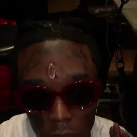 #LilUzi implanted a $24 mill diamond on his forehead 💎🤔 Big flex or nah?