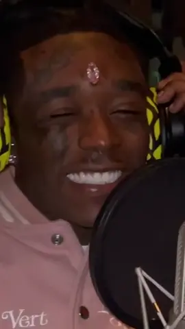 Lil Uzi Vert has had a $26M Pink Diamond Implanted In His Face 😳🤯💎 #vvip #liluzi #liluzivert #babypluto #hiphop #rap #fyp #foryou #viral #xyzbca