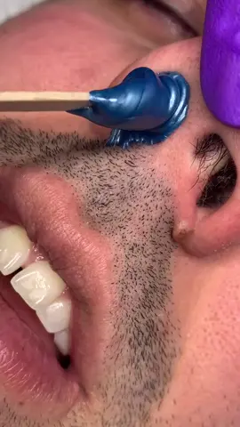 Man I love my job nothing feels better then pulling out some nose hairs 😅🤩 #nosewaxing #nosewax #fyp #foryoupageofficiall ￼