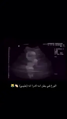 😹😹😹😹#كسبلور#فولو #لايك #تصاميمي #دندون_السميري #عتيبه #الهيلا #شيلات #طرب