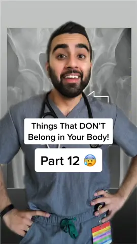 Worst way to work out 🏋️‍♀️ #xray #foreignbody #foreignobject #dontdothis #medicine #doctor #medicalschool #bakedoats #homecook